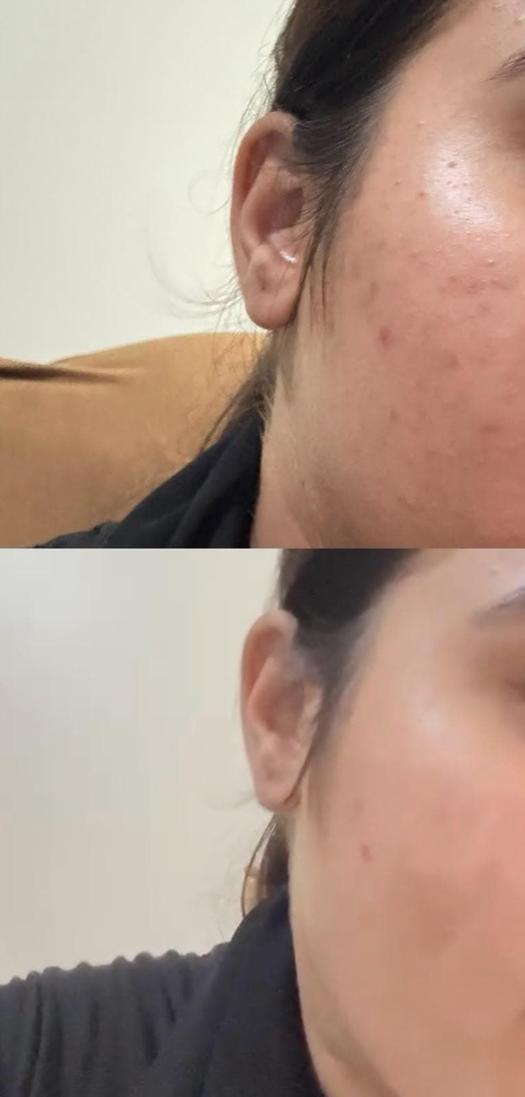 Before and After